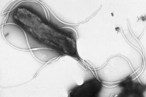 H. pylori bacteria H. pylori