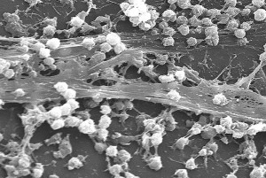 S. aureus biofilm S. aureus biofilm