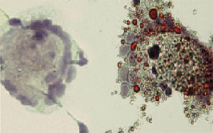 macrophage-cells-with-and-without-cholesterol