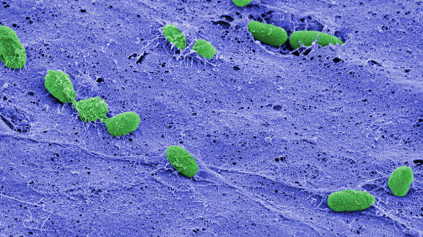 In this false-colored image, individual cells of Pseudomonas aeruginosa (green) can be seen resting on the fibrous surface of a biofilm (purple) that helps protect cells beneath its surface. At top right, two cells incorporated within the biofilm peek out from a fissure in the film's surface. CREDIT Debra Weinstein, Sao-Mai Nguyen-Mau, and Vincent Lee In this false-colored image, individual cells of Pseudomonas aeruginosa (green) can be seen resting on the fibrous surface of a biofilm (purple) that helps protect cells beneath its surface. At top right, two cells incorporated within the biofilm peek out from a fissure in the film's surface. CREDIT Debra Weinstein, Sao-Mai Nguyen-Mau, and Vincent Lee