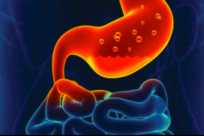 Effects of Low Stomach Acid and PPI Use